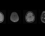 fastMRI 2020 Brain MRI reconstruction Challenge